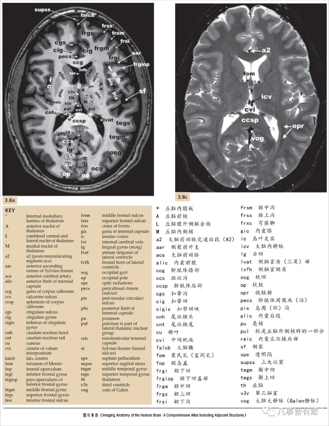 五,脑干轴位断层解剖示意图section anatomy特别申明:以上美图来自多