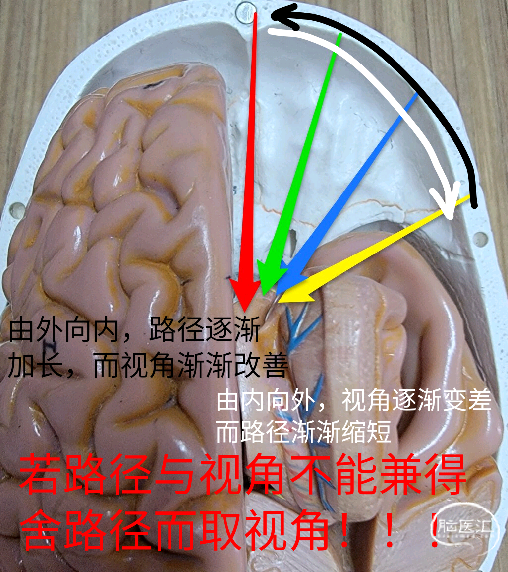 大致范围是在中脑背侧-三室后部与小脑山顶之间,组成包括四叠体池