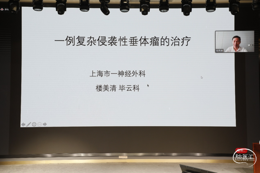 上海市第一人民医院楼美清教授通过视频连线,分享了"一例复杂垂体瘤的