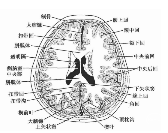 经顶枕沟上份的横断层面图-4经半卵圆中心的横断层面左,右侧大脑半球