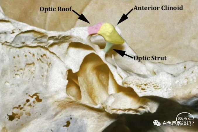 颈内动脉和动眼神经;硬膜外扒开颞尖;视神经管减压;经前外侧(蝶骨嵴