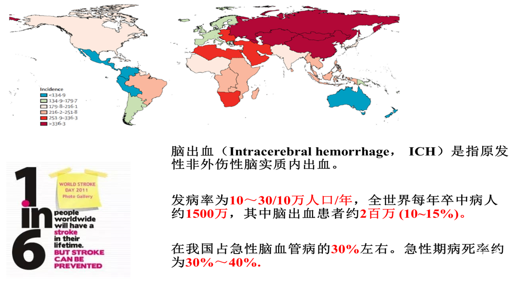 致残率高死亡率高发病率高三高"雅尔塔三巨头"均死于脑出血流行病学