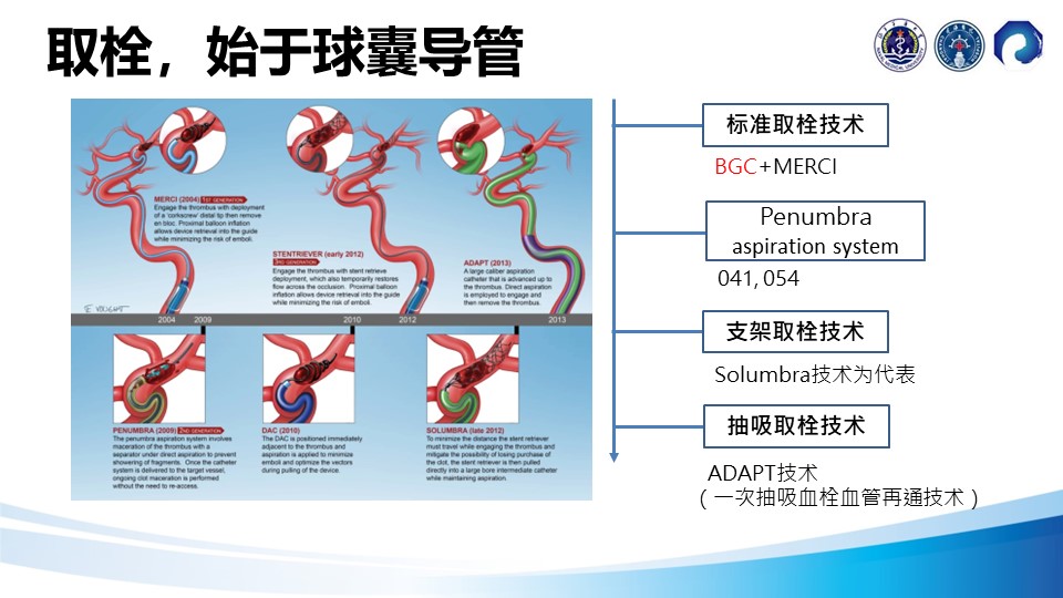 邢鹏飞教授球囊导管在机械取栓中的临床应用 脑医汇 神外资讯 神介资讯