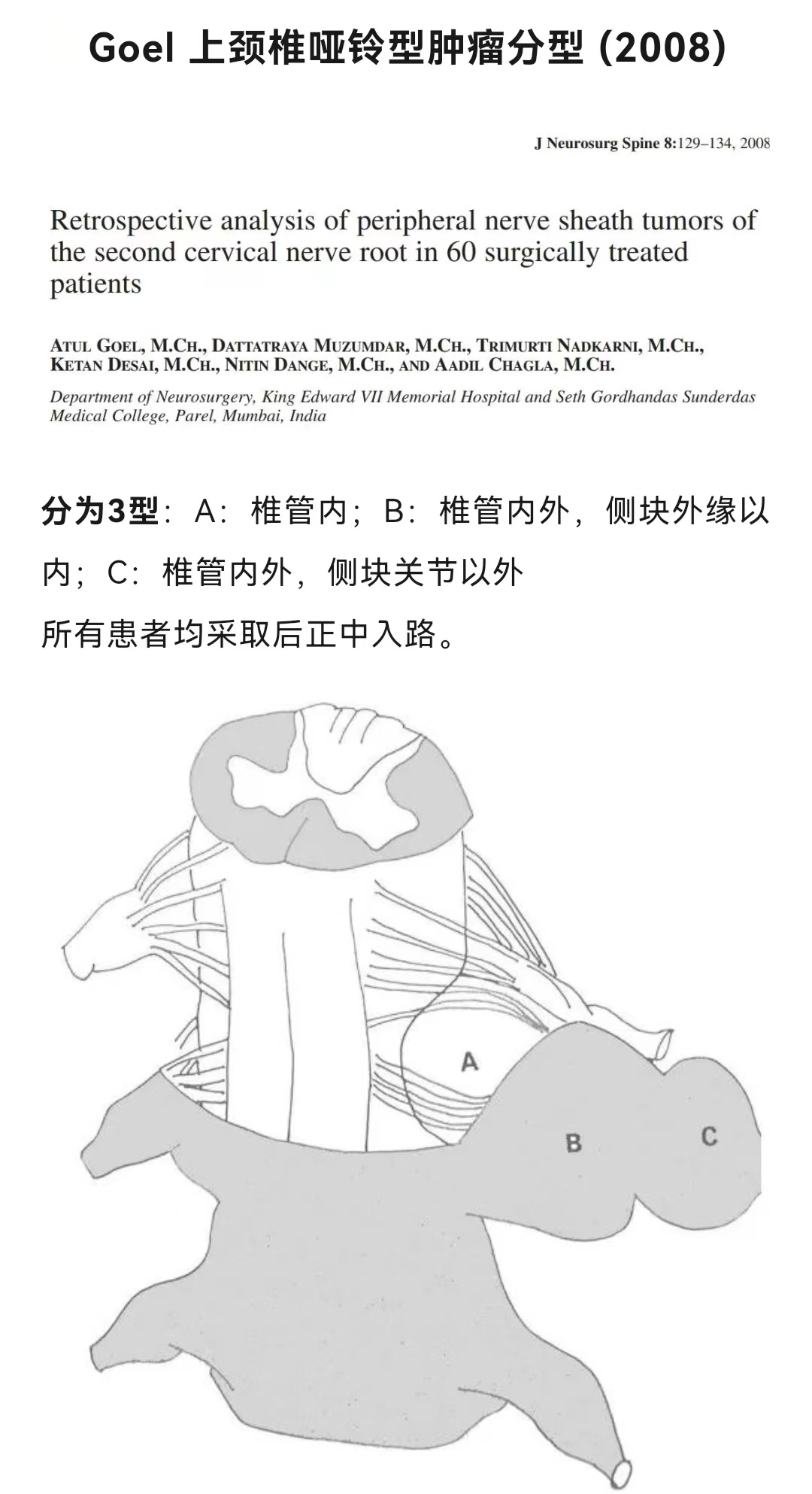 经腹前入路翻修显微切除椎旁肿瘤 - 脑医汇