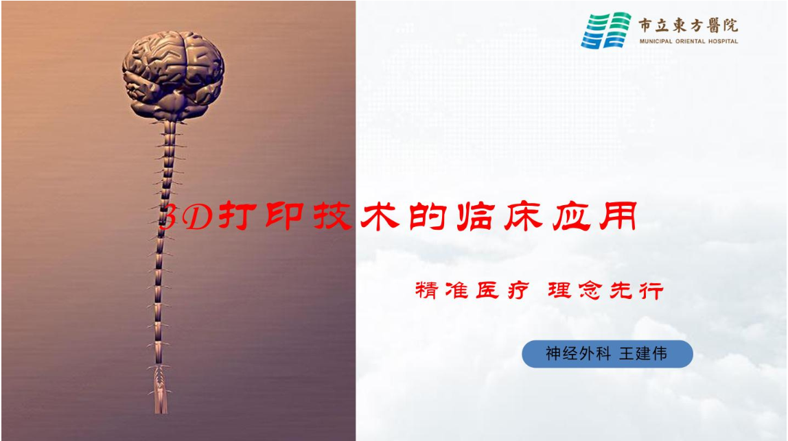 3D打印技术在神经外科的应用