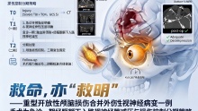 救命,亦“救明” ——重型开放性颅脑损伤合并外伤性视神经病变一例：急诊一期经额下视神经管减压与损伤控