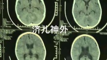 一例幼儿巨大CPA区四脑室巨大肿瘤治疗方案。