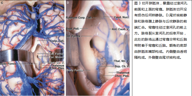 解剖研究から実践手術へ 後頭蓋窩の微小外科解剖と手術 - 健康/医学