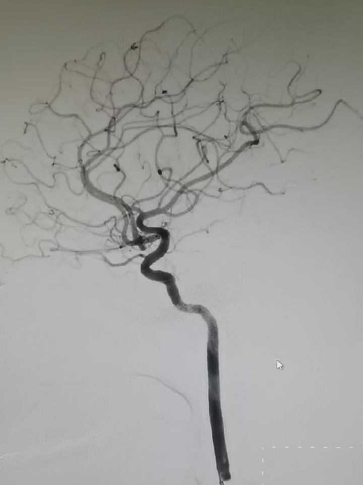 泥鳅导丝怎么用一招制敌_https://www.jmylbn.com_新闻资讯_第7张