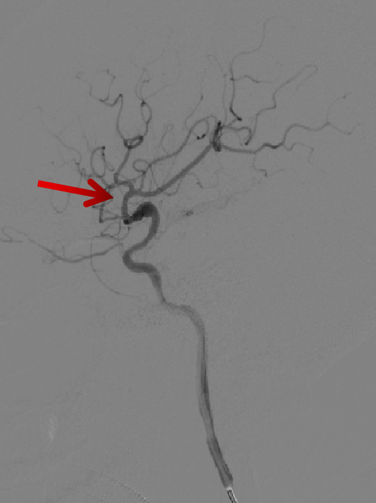 泥鳅导丝怎么用一招制敌_https://www.jmylbn.com_新闻资讯_第11张