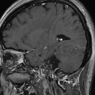 泥鳅导丝怎么用一招制敌_https://www.jmylbn.com_新闻资讯_第5张