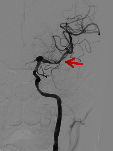 泥鳅导丝怎么用一招制敌_https://www.jmylbn.com_新闻资讯_第10张