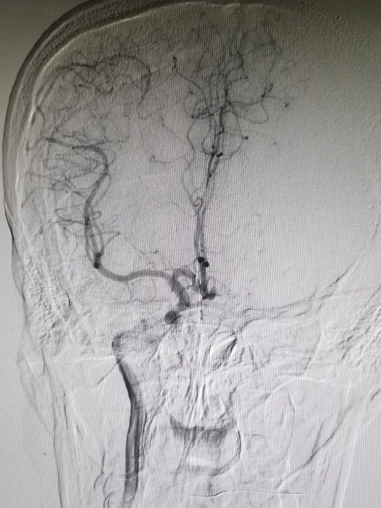 泥鳅导丝怎么用一招制敌_https://www.jmylbn.com_新闻资讯_第6张