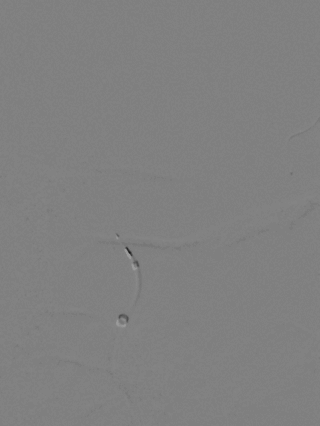 泥鳅导丝怎么用一招制敌_https://www.jmylbn.com_新闻资讯_第20张