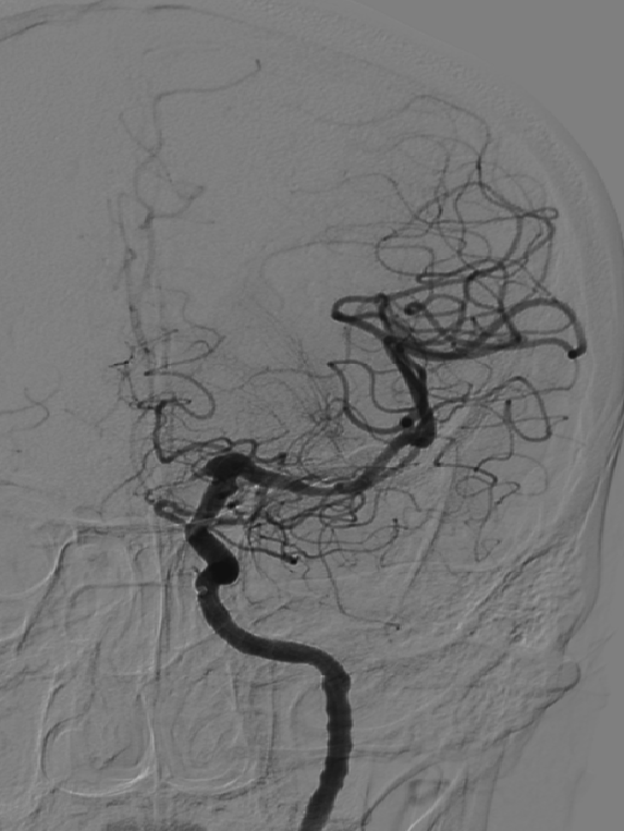 泥鳅导丝怎么用一招制敌_https://www.jmylbn.com_新闻资讯_第26张