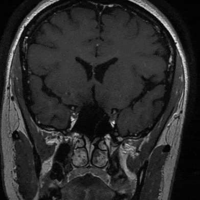 泥鳅导丝怎么用一招制敌_https://www.jmylbn.com_新闻资讯_第4张