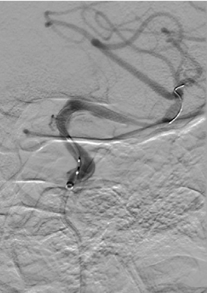 泥鳅导丝怎么用一招制敌_https://www.jmylbn.com_新闻资讯_第18张