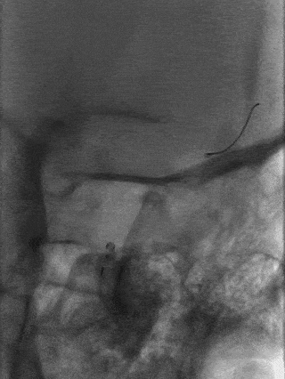 泥鳅导丝怎么用一招制敌_https://www.jmylbn.com_新闻资讯_第21张