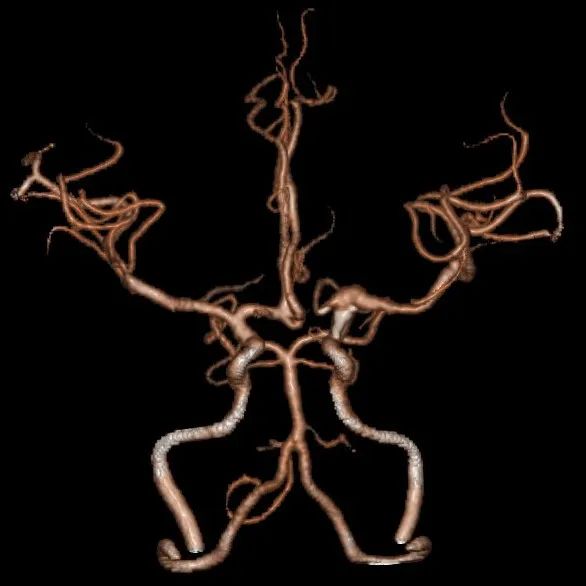 泥鳅导丝怎么用一招制敌_https://www.jmylbn.com_新闻资讯_第3张