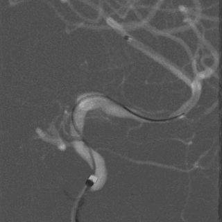 泥鳅导丝怎么用一招制敌_https://www.jmylbn.com_新闻资讯_第13张