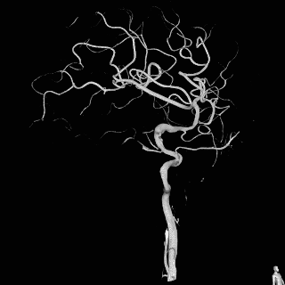 泥鳅导丝怎么用一招制敌_https://www.jmylbn.com_新闻资讯_第9张