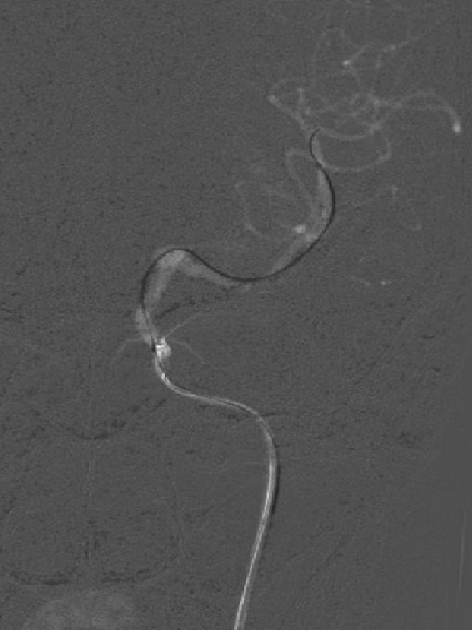 泥鳅导丝怎么用一招制敌_https://www.jmylbn.com_新闻资讯_第12张