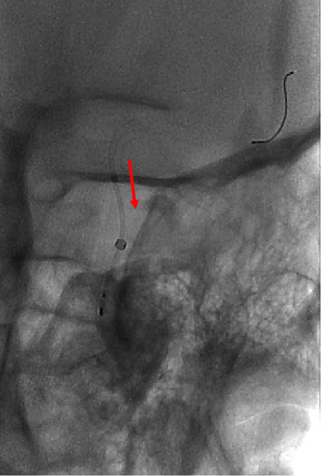 泥鳅导丝怎么用一招制敌_https://www.jmylbn.com_新闻资讯_第16张