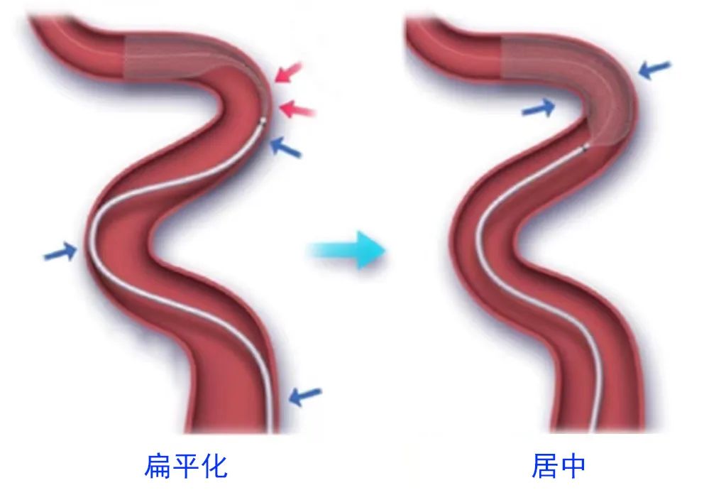 泥鳅导丝怎么用一招制敌_https://www.jmylbn.com_新闻资讯_第17张