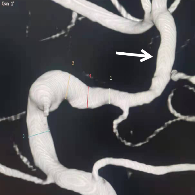 泥鳅导丝怎么用一招制敌_https://www.jmylbn.com_新闻资讯_第8张