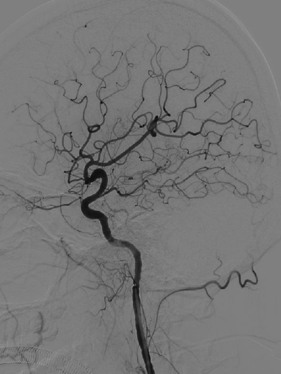 泥鳅导丝怎么用一招制敌_https://www.jmylbn.com_新闻资讯_第25张