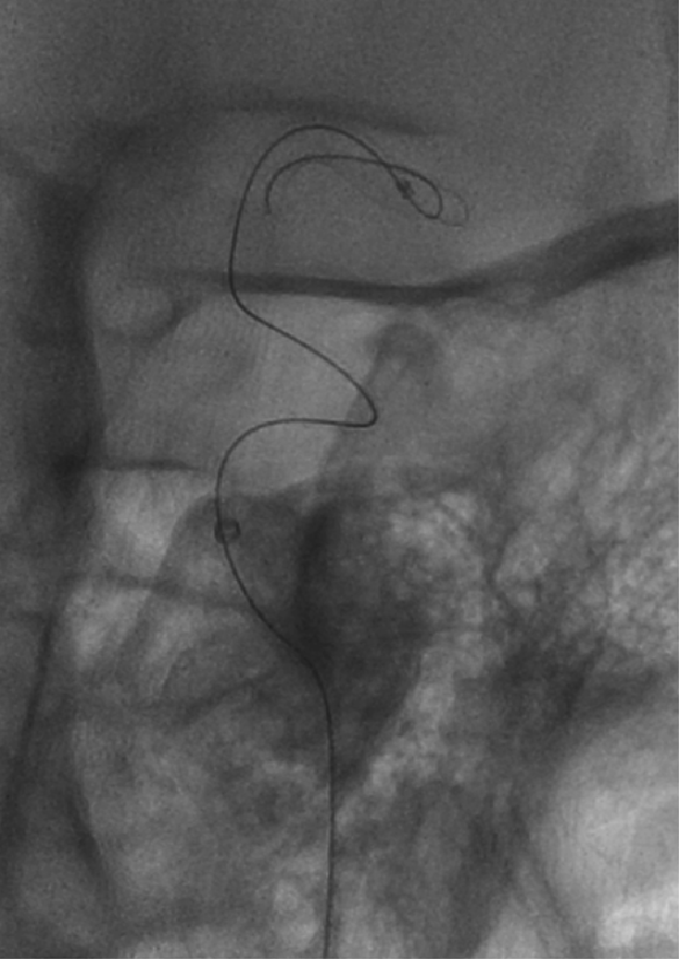 泥鳅导丝怎么用一招制敌_https://www.jmylbn.com_新闻资讯_第22张