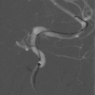 泥鳅导丝怎么用一招制敌_https://www.jmylbn.com_新闻资讯_第14张