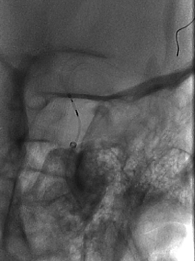 泥鳅导丝怎么用一招制敌_https://www.jmylbn.com_新闻资讯_第19张