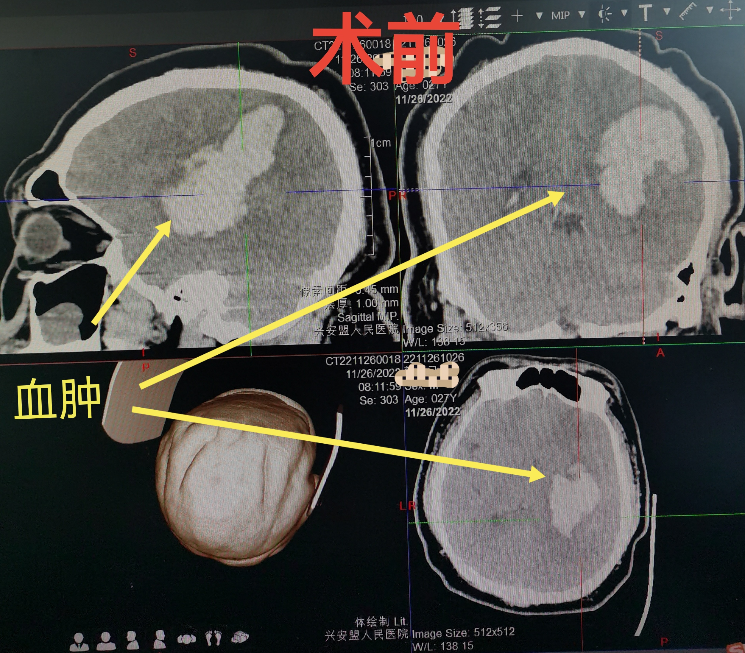 无效图片