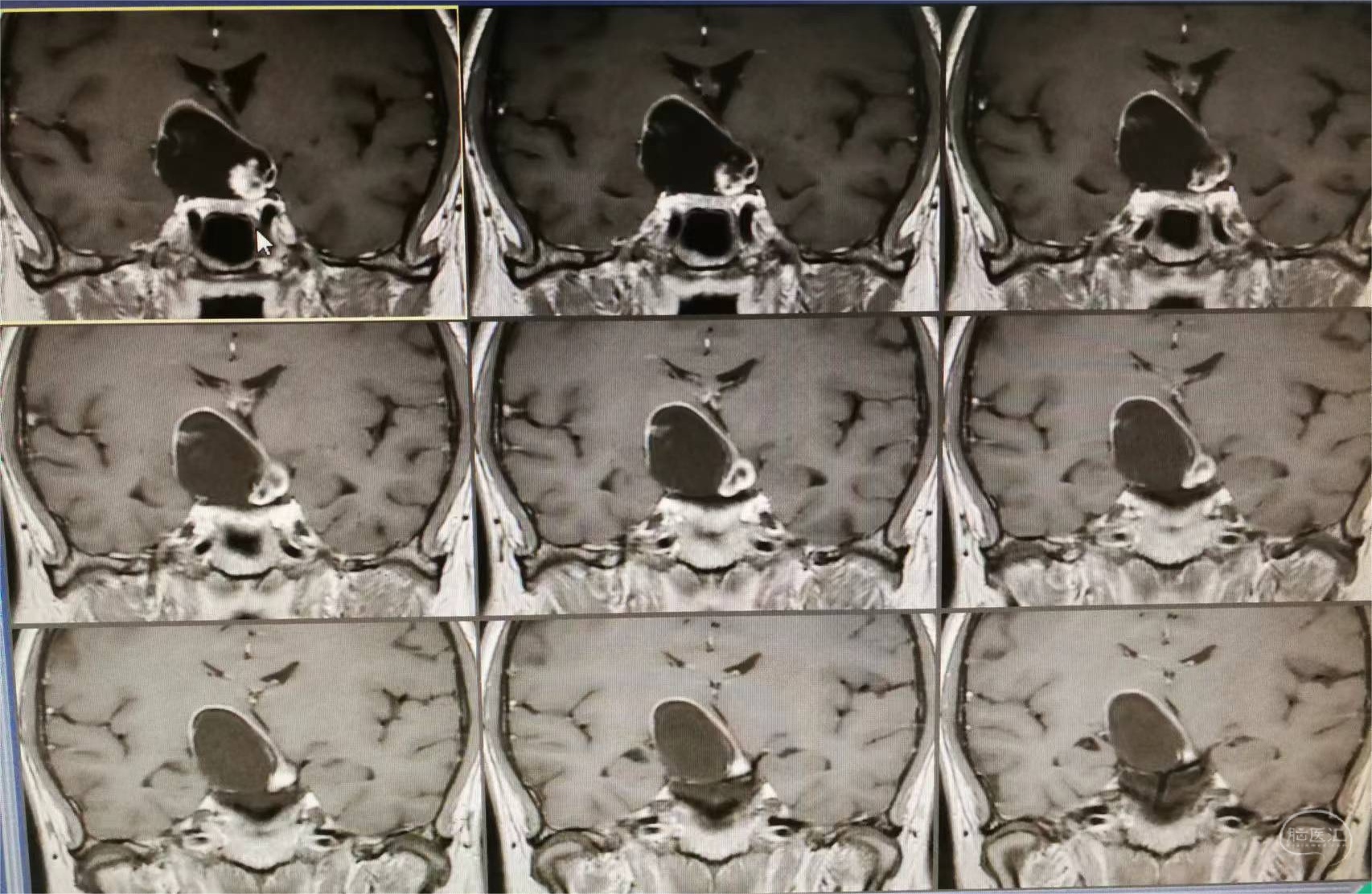 北医三院门诊预约CT加急-北医三院门诊预约ct加急要多久 北医三院门诊预约CT加急-北医三院门诊预约ct加急要多久