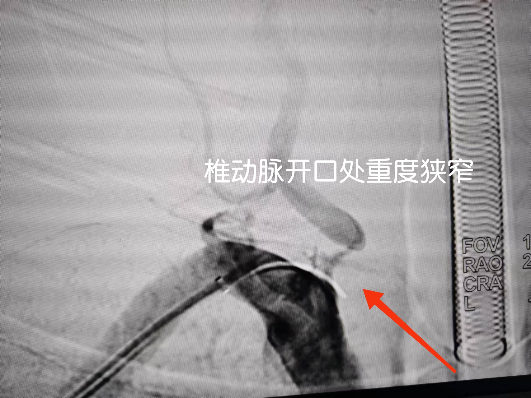 无效图片