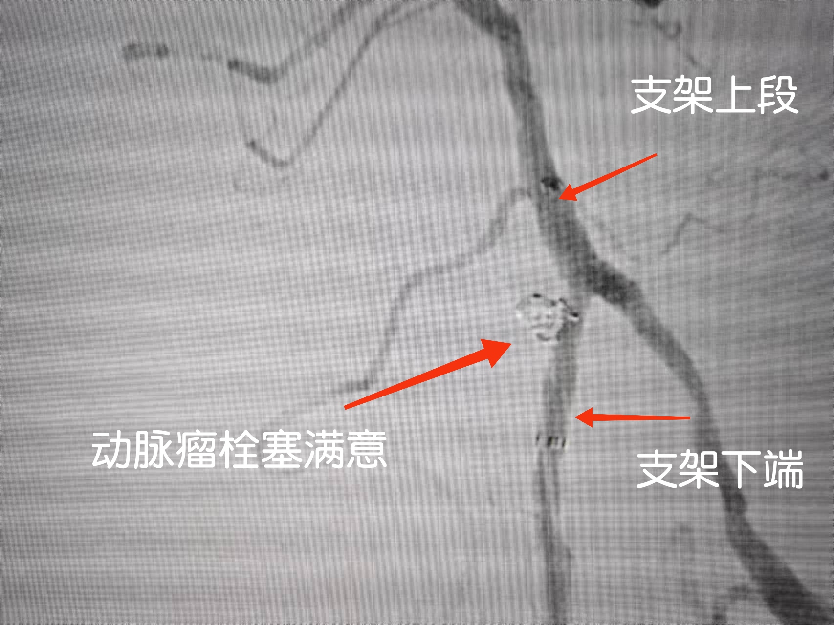 无效图片