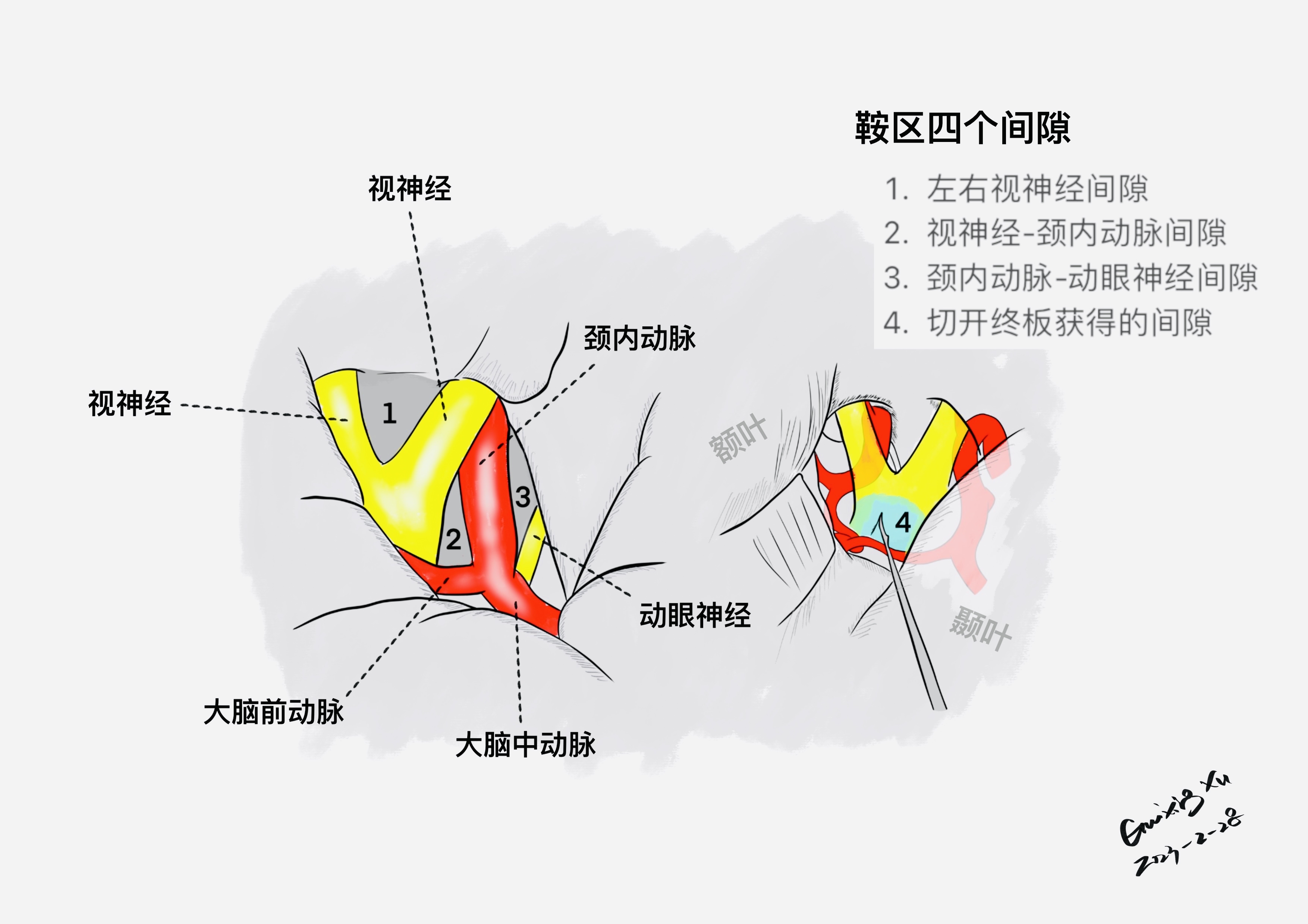 鞍区四间隙 - 脑医汇
