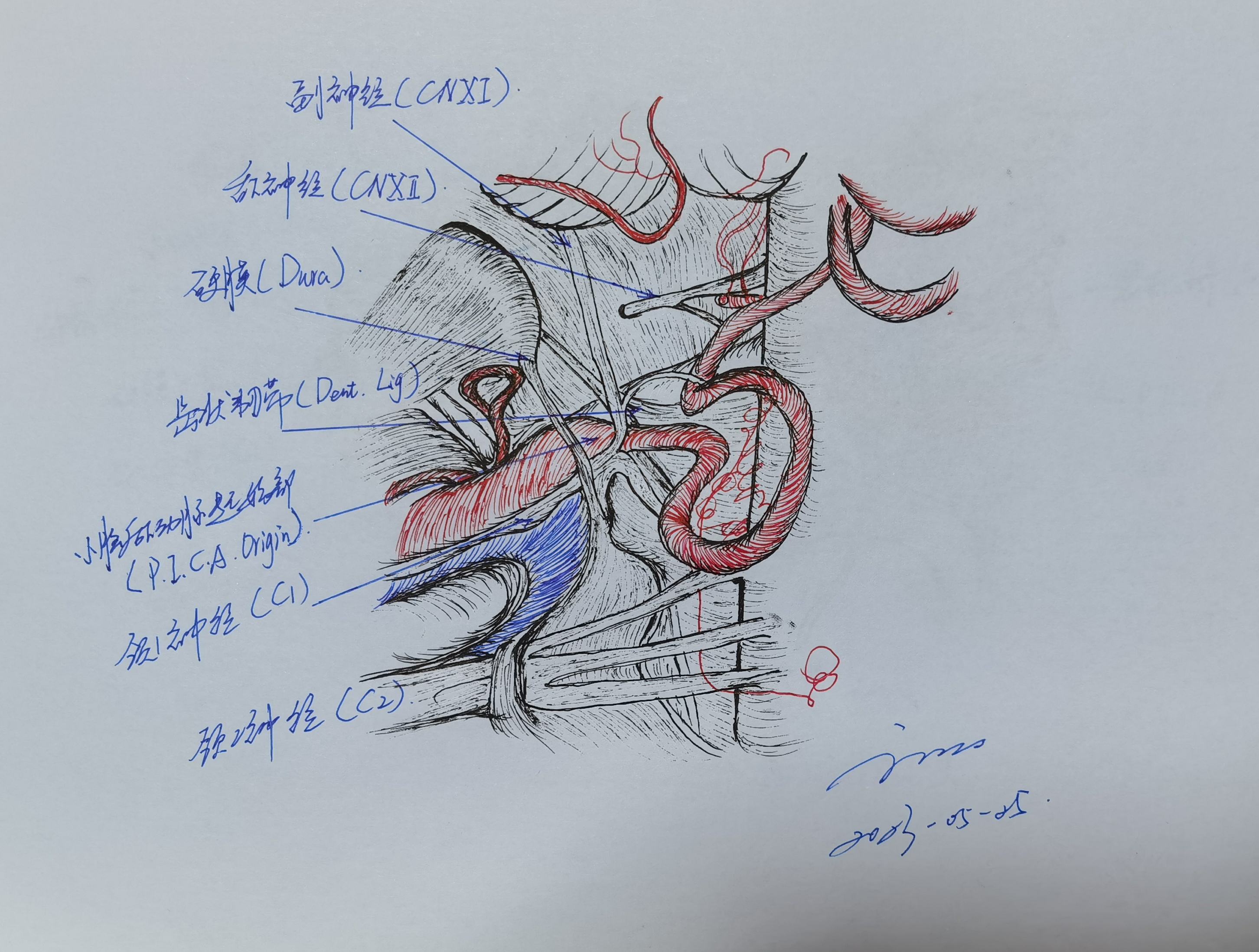 学习RHOTON解剖学手绘—小脑后下动脉（PICA）毗邻关系和起源 - 脑医汇