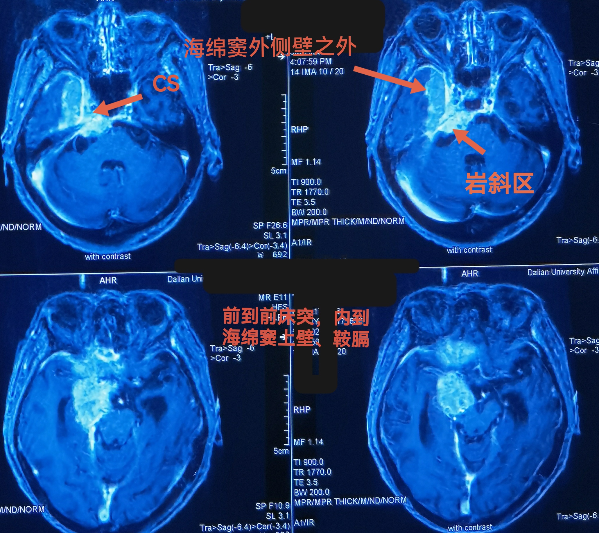 无效图片