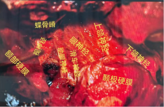 无效图片