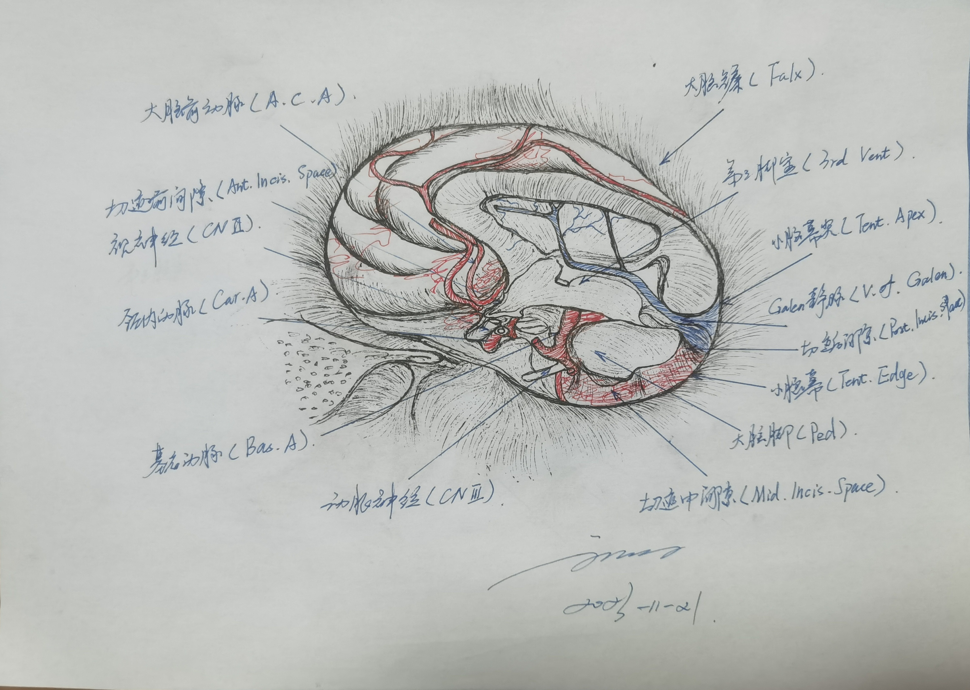 学习RHOTON解剖学手绘—小脑幕切迹 - 脑医汇