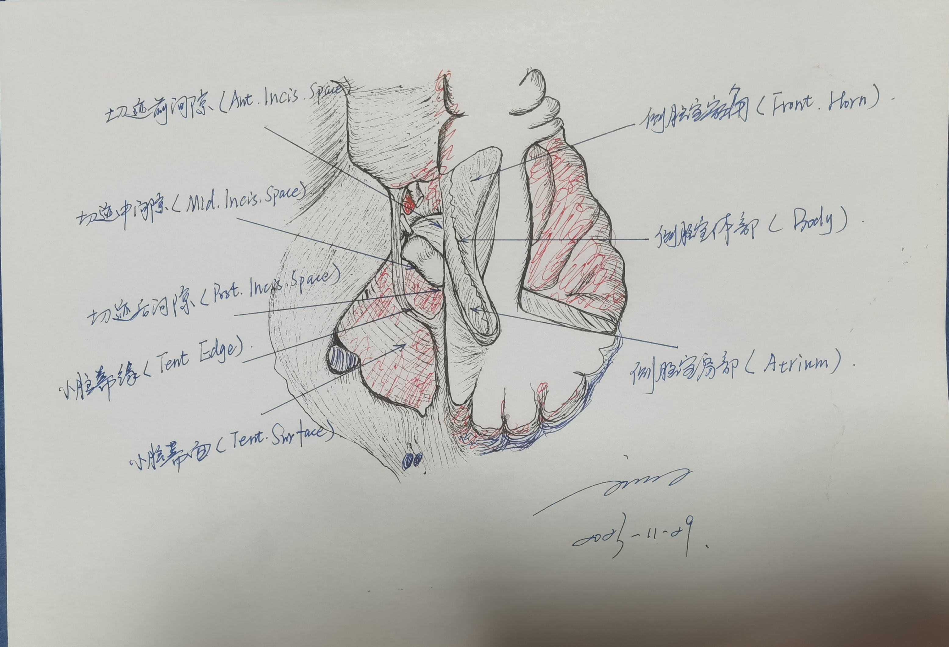 小脑幕解剖图片