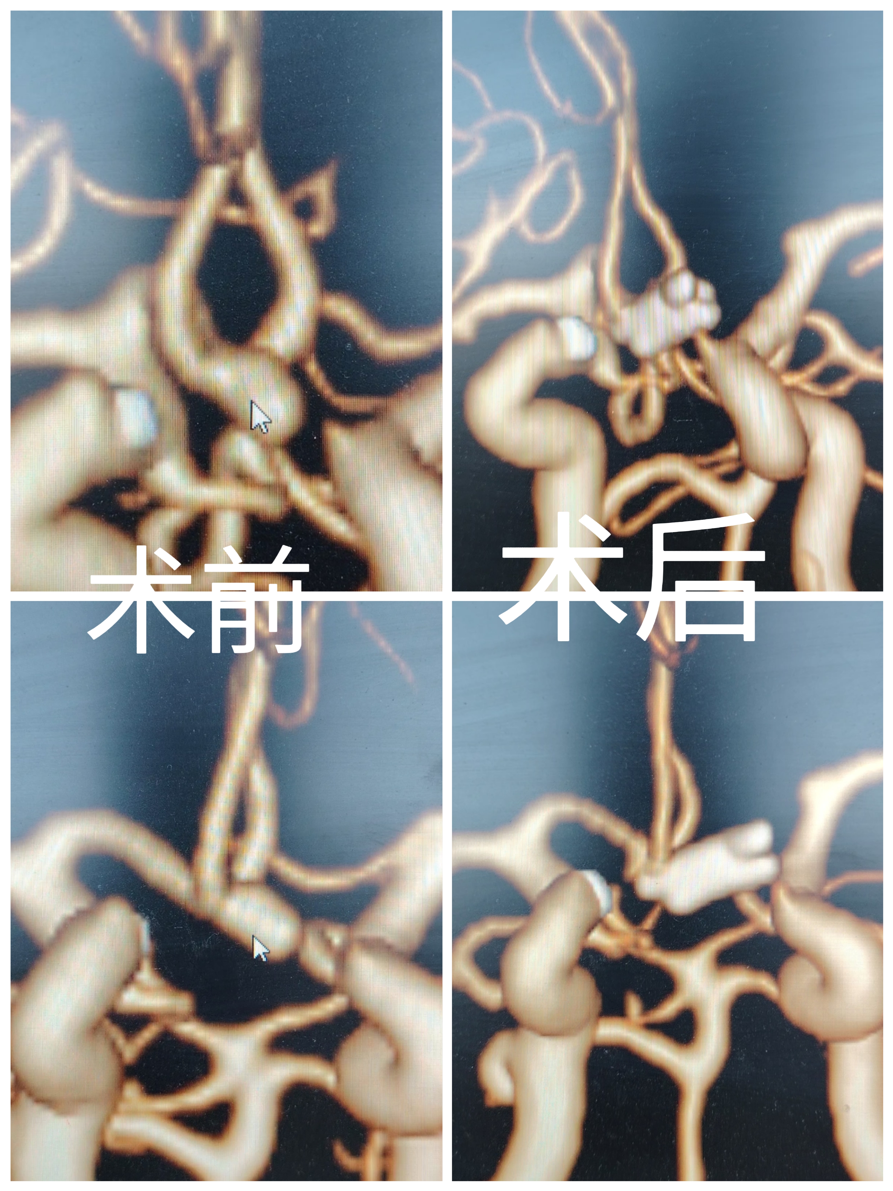无效图片