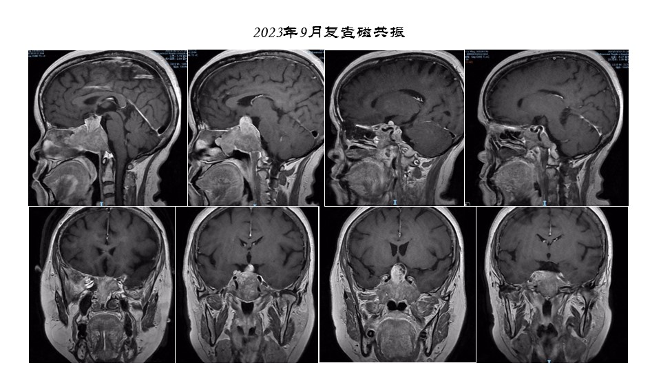无效图片