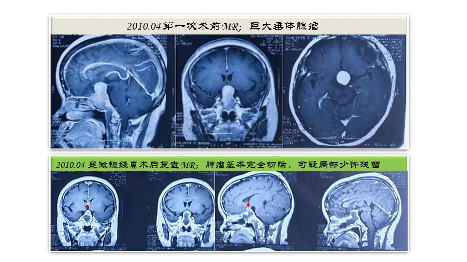 无效图片