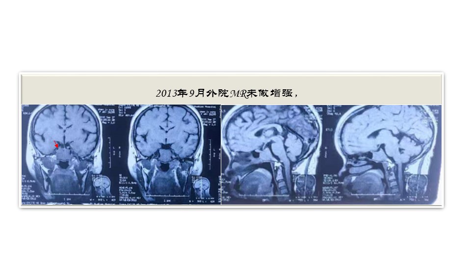 无效图片