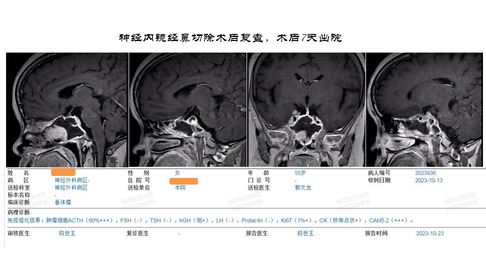 无效图片