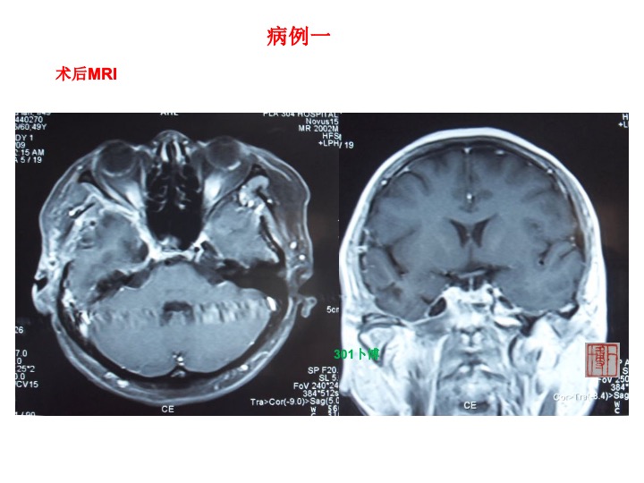 无效图片