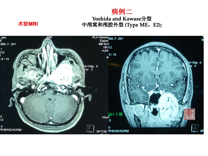 无效图片